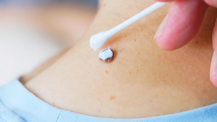 lazer de yaptiran da var solusyon suren de her ben masum degil incelenmeli SfMJaNFl.jpg